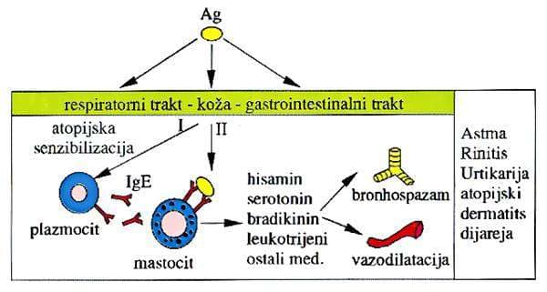 Šema atopijske reakcije